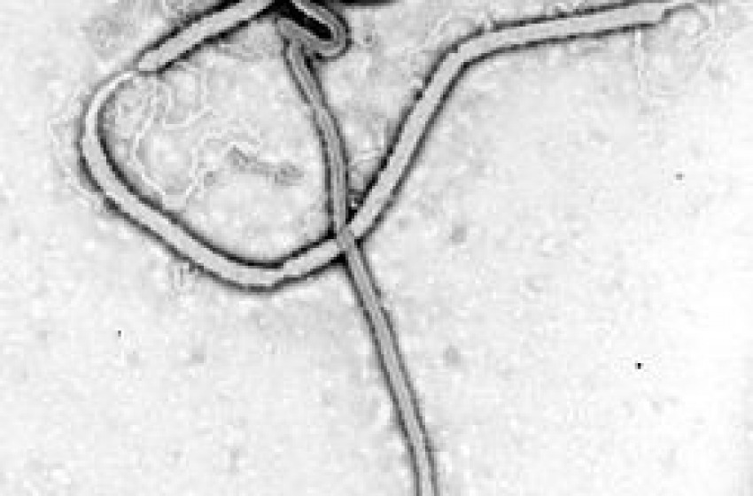 Presunto caso Ebola a Teramo, allarme rientrato