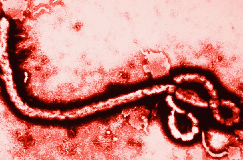 Ebola, da Notaresco un cerotto per l'emergenza