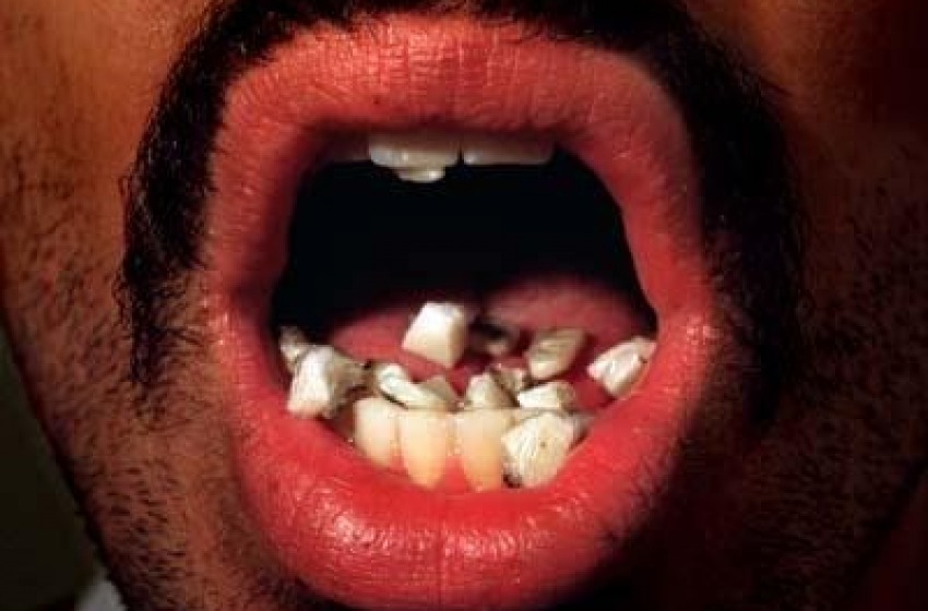 Lanciano. Lo spaccio è chic