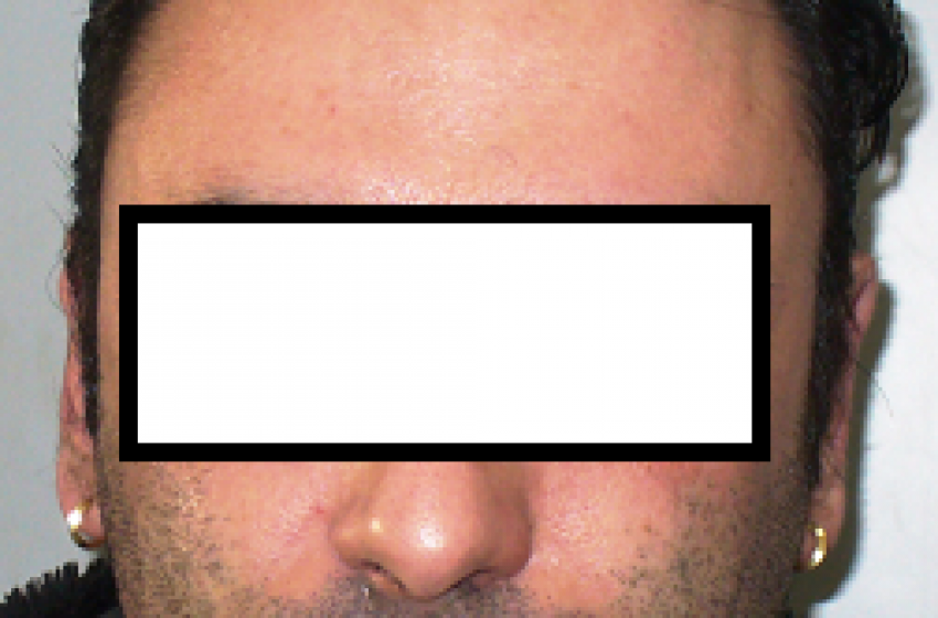 Massacrò di botte fratello e sorella per una sfida persa al braccio di ferro