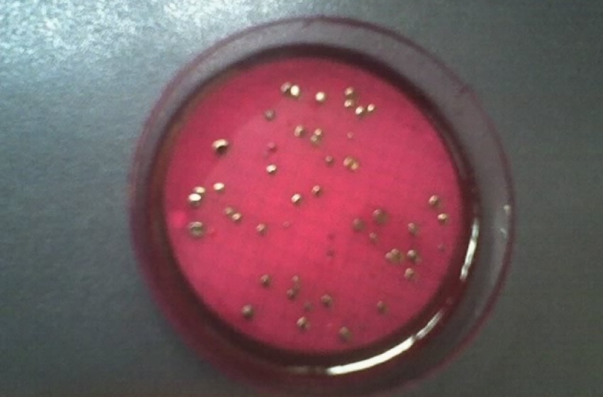 Batteri coliformi nell'acqua