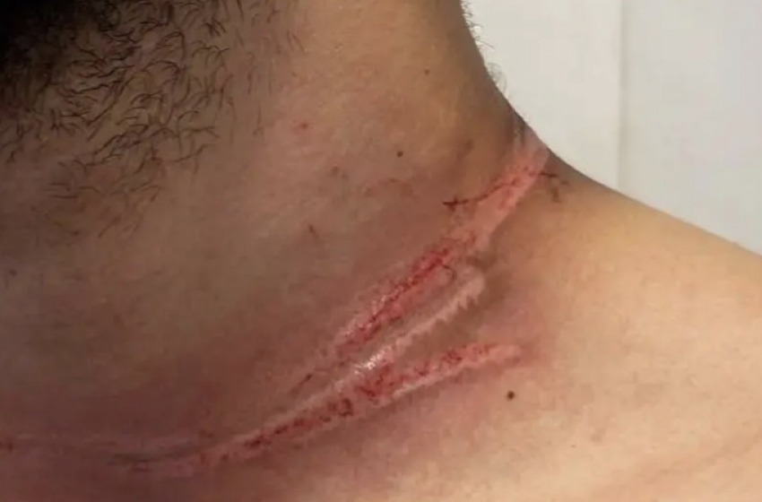 Trappola sulla Piana dell&rsquo;Aremogna, motociclista sfiora la tragedia  