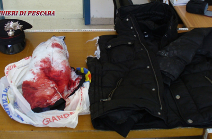 Accoltellato al gluteo per un motivo banale: 19enne denunciato per lesioni